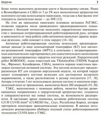 Эндопротезирование коленного сустава с использованием операционного робота - Фото 3