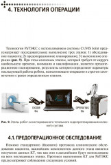 Эндопротезирование коленного сустава с использованием операционного робота - Фото 5