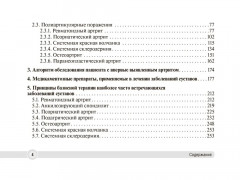 Суставной синдром в практике врача поликлиники - Фото 2