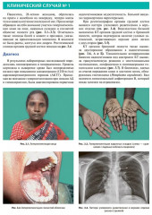 Атлас клинической эндокринологии и диабета. Сборник клинических случаев. Диагностика и лечение - Фото 6