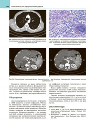Атлас клинической эндокринологии и диабета. Сборник клинических случаев. Диагностика и лечение - Фото 7