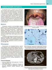 Атлас клинической эндокринологии и диабета. Сборник клинических случаев. Диагностика и лечение - Фото 8
