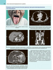 Атлас клинической эндокринологии и диабета. Сборник клинических случаев. Диагностика и лечение - Фото 9