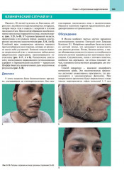 Атлас клинической эндокринологии и диабета. Сборник клинических случаев. Диагностика и лечение - Фото 10