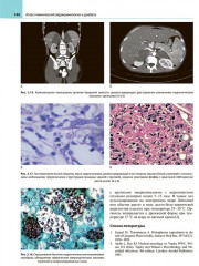 Атлас клинической эндокринологии и диабета. Сборник клинических случаев. Диагностика и лечение - Фото 11
