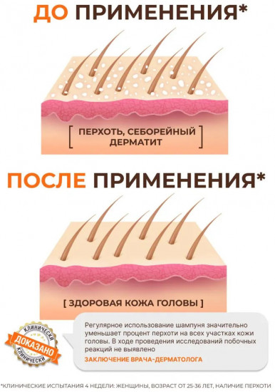Шампунь против перхоти с амикрозолом