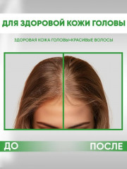 Пилинг для кожи головы с салициловой кислотой - Фото 4