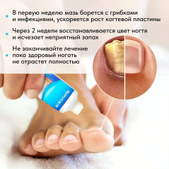 Мазь для лечения грибка ногтей «Nail Fungus» - Фото 1