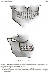 Пропедевтика ортодонтии - Фото 8