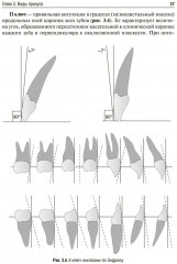 Пропедевтика ортодонтии - Фото 12