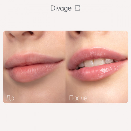 Бальзам для губ «Marbled Lip Balm», тон 01 Розовый нюд