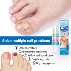 Жидкость от грибка ногтей «Nail Revive Pen» - Фото 2