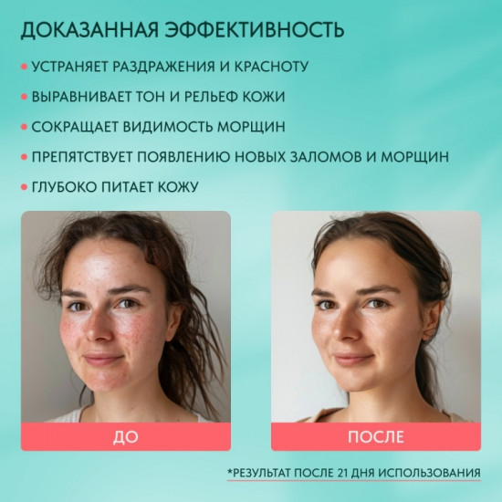 Эмульсия для лица «Cica Care Toner Emulsion»