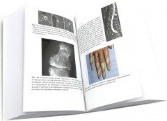 Ревматология: оксфордский справочник - Фото 2