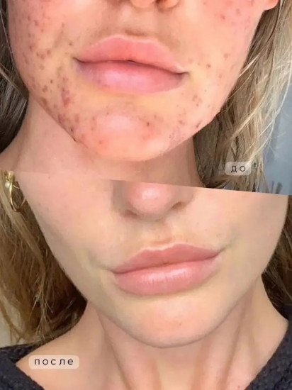 Очищающая пенка отбеливающая «Whitening Facial Clenser»