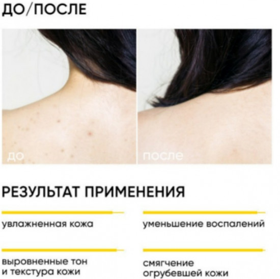 Крем для тела с кислотами обновляющий «Smart Skin Renewal»