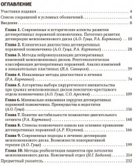 Патология межпозвонкового диска. Поясничный отдел - Фото 1