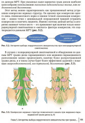Патология межпозвонкового диска. Поясничный отдел - Фото 6