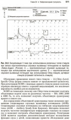 Болезни уха, горла, носа в детском возрасте. Национальное руководство. Краткое издание - Фото 13
