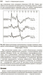 Болезни уха, горла, носа в детском возрасте. Национальное руководство. Краткое издание - Фото 14