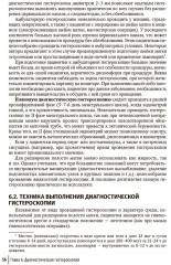 Гистероскопия. Диагностика и лечение внутриматочных заболеваний - Фото 6