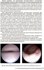 Гистероскопия. Диагностика и лечение внутриматочных заболеваний - Фото 7