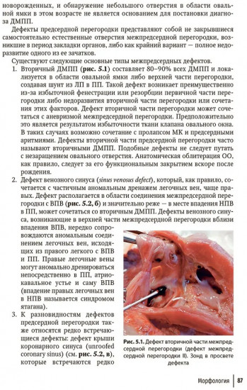 Врожденные пороки сердца у детей