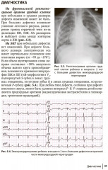 Врожденные пороки сердца у детей - Фото 7