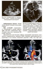 Врожденные пороки сердца у детей - Фото 8