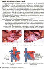 Врожденные пороки сердца у детей - Фото 10