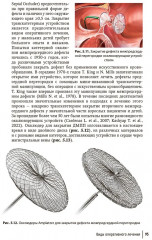 Врожденные пороки сердца у детей - Фото 11