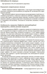 Врожденные пороки сердца у детей - Фото 13