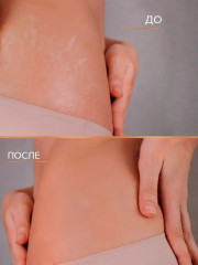 Крем-баттер для тела против растяжек питательный - Фото 6