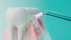 Ирригатор Sonicare HX3826/33 - Фото 4