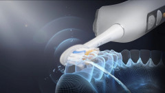 Зубная щетка электрическая с ирригатором Neos T03 - Фото 19