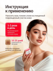 Мазь от псориаза, грибка, лишая «Король Кожи» - Фото 1