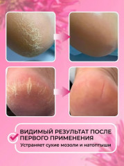 Кератолитик с экстрактом монарды «Lotion Monarda Care» - Фото 4