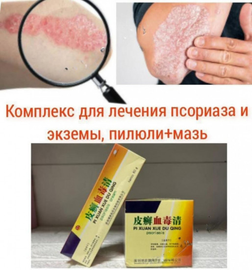 Мазь от псориаза и кожный заболеваний