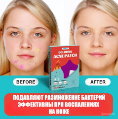 Цветные патчи-звездочки от акне и прыщей - Фото 5