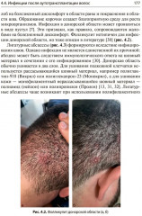 Состояние волос при инфекционных заболеваниях. Диагностика, лечение и профилактика - Фото 13