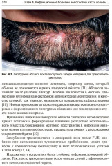 Состояние волос при инфекционных заболеваниях. Диагностика, лечение и профилактика - Фото 14