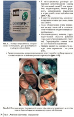 Колоректальная хирургия. Иллюстрированные советы и практические рекомендации - Фото 8