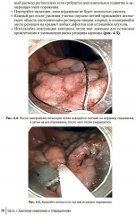 Колоректальная хирургия. Иллюстрированные советы и практические рекомендации - Фото 10