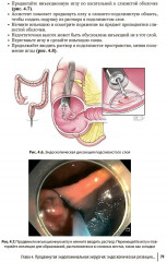Колоректальная хирургия. Иллюстрированные советы и практические рекомендации - Фото 13