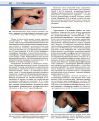 Дерматология по Фицпатрику. Том 2 - Фото 12