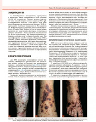 Дерматология по Фицпатрику. Том 3 - Фото 8