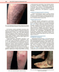 Дерматология по Фицпатрику. Том 3 - Фото 11