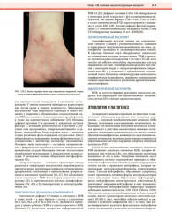 Дерматология по Фицпатрику. Том 3 - Фото 12