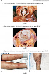 Патологическая анатомия. Клиническая морфология заболеваний человека - Фото 8