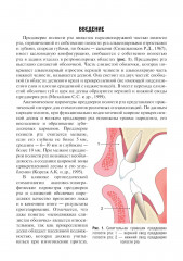 Вестибулопластика - Фото 3